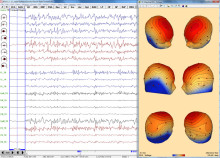 EEG-Review-3DMap