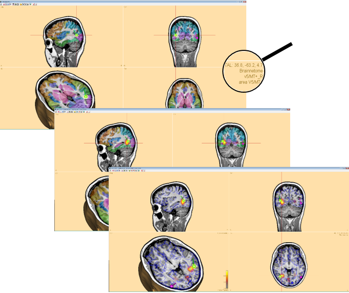 Atlas display