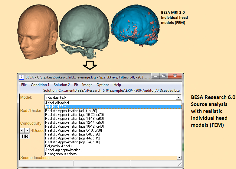 BESA-MRI_Individual-realistic-head-models
