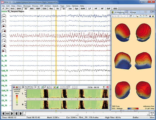 image-content-top_besa-research-features-data-review-and-processing