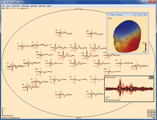 image-content-top_besa-research-features-erp-analysis-and-averaging