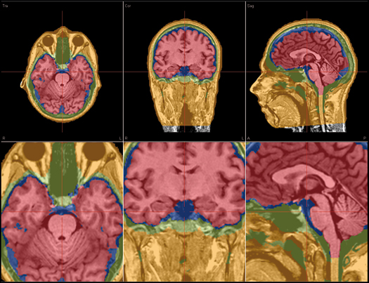 image-content-top_besa-research-features-integration-with-mri-and-fmri