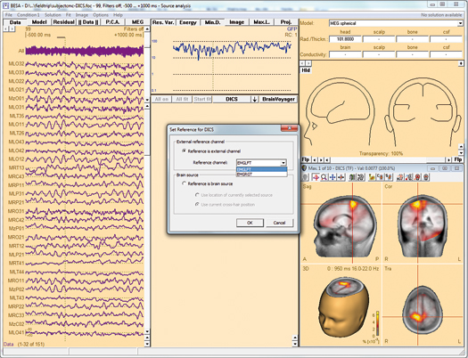 image-content-top_besa-research-features-source-coherence