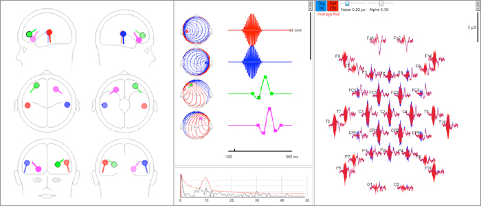 image-content-top_besa-simulator-overview