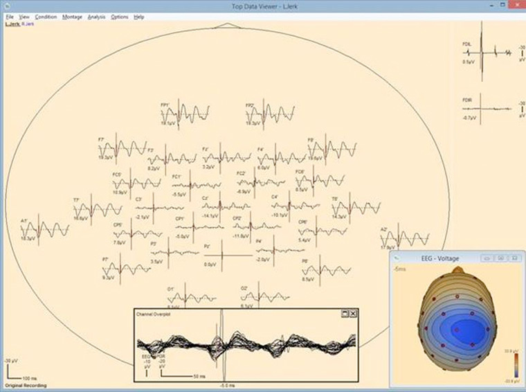 besa-research-screen_Top-Viewer_Additional-Channels