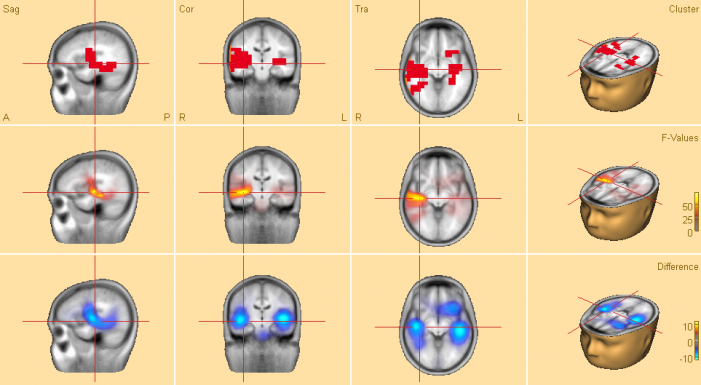 Optimal_Viz