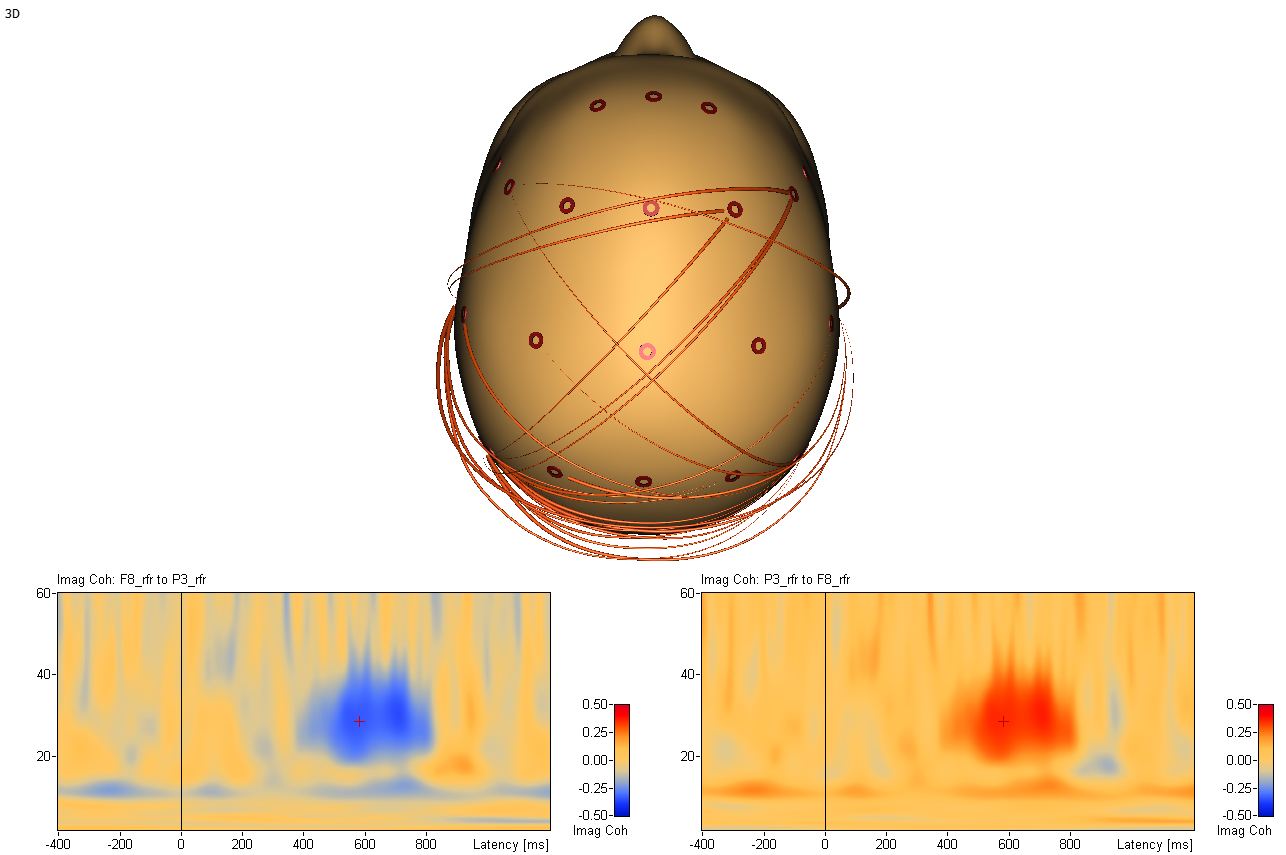 Connectivity in sensor space